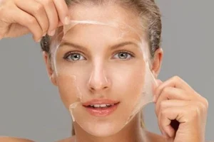 TCA Peeling Ne İşe Yarar