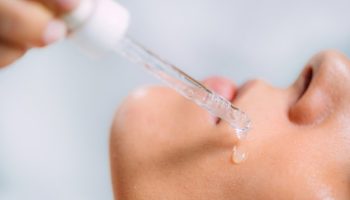 TCA Peeling Yaptıranlar