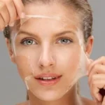 Tca Peeling Kullananlar